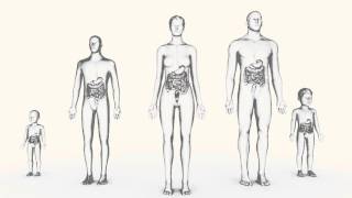 UIcerative Colitis 101 [upl. by Kensell]