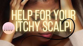 Itchy tight dry scalp solution for YOU [upl. by Reffotsirhc178]