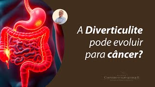 A diverticulite pode evoluir para câncer  Prof Dr Luiz Carneiro CRM 22761 [upl. by Suirtimed]