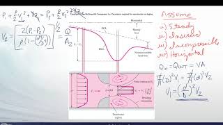 FM10 B1 Obstruction Flow Devices [upl. by Izabel]