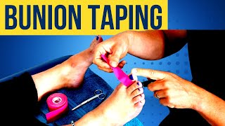 Bunion Taping Video [upl. by Nenerb]