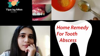 TREAT GUM ABSCESS AT HOME SELF TESTED [upl. by Aicxela]