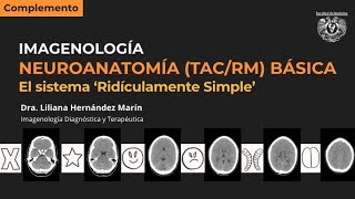 Neuroanatomía seccional básica TAC y RM  El sistema quotridículamente simplequot [upl. by Coltin308]