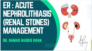 RENAL STONES  ER ACUTE MANAGEMENT NEPHROLITHIASIScasestudy emergency education [upl. by Luhe]