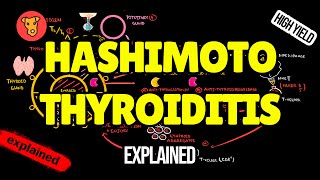 HASHIMOTO THYROIDITIS Pathogenesis Clinical Symptoms Treatment [upl. by Adnalra]