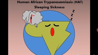 Human African Trypanosomiasis HAT Tbrucei مرض النوم [upl. by Lesig]