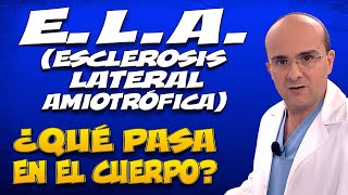 ELA o ESCLEROSIS LATERAL AMIOTRÓFICA  ¿Qué pasa dentro del cuerpo de quienes la padecen [upl. by Esened]