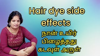 Hair dye side effects நான் உயிர் பிழைத்தது கடவுள் அருள் [upl. by Kucik]