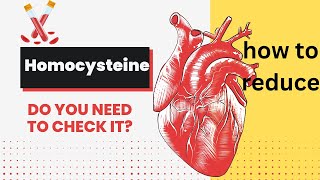 HOMOCYSTEINE WHEN TO CHECK IT  HOW TO REDUCE HOMOCYSTEINE LEVELS  HOMOCYSTEINE BLOOD TEST [upl. by Mun]