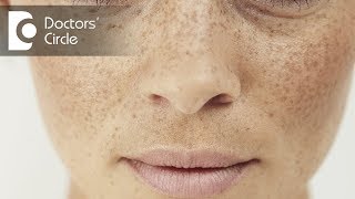 What is Pigmentation and how can you treat it  Dr Aruna Prasad [upl. by Eniamret]