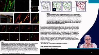 Microscopy  II swayamprabha ch17sp [upl. by Broderic]