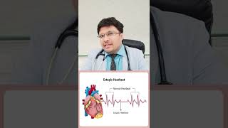 Ectopic Heartbeat Relief Quick Tips See How [upl. by Matless]