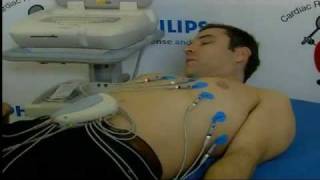 David Walliams has an ECG [upl. by Aggi]