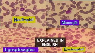 NeutrophilLymphocytemonocyte amp eosinophil actual view under microscopehow to differentiate easily [upl. by Ilesara]