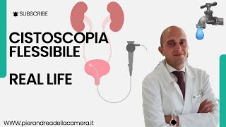 REAL LIFE CISTOSCOPIA FLESSIBILE [upl. by Dremann]