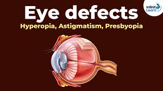 Eye defects  Hyperopia Astigmatism Presbyopia  Dont Memorise [upl. by Lebiram]