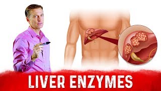 High Liver Enzymes ALT amp AST – What Do They Mean – DrBerg [upl. by Pamella322]