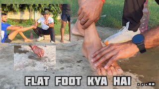 What is Flat FootFlat Foot Kya HaiMedical Test Flat Foot 2023 101 Problem Solve Defence Medical [upl. by Isabea]