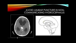 Cerebrospinal fluid [upl. by Wilcox715]