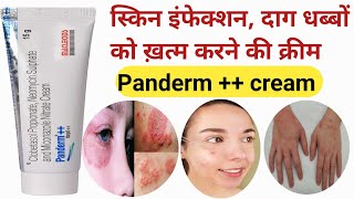 Panderm cream  Panderm cream Panderm cream use in Hindi  pendram cream ke fayde  shorts [upl. by Sension]