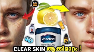 Skinnmaxxing Malayalam  lookmaxing 230clear skin [upl. by Otrebogad]