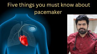 Five important facts about pacemakers you need to know  Doctor aditha cibi [upl. by Harrington]