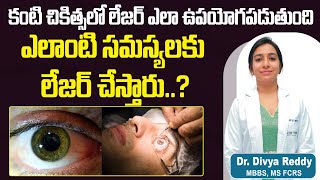 కంటి చికిత్సలో లేజర్ ఉపయోగాలు  How Laser Works in Eye Surgery  Best Vision Eye Hospital [upl. by Selhorst]