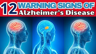 12 WARNING SIGNS OF ALZHEIMERS DISEASE [upl. by Diella800]