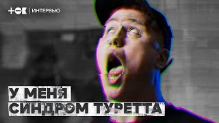 Руслан CMH о жизни с синдромом Туретта  ТОК  удаленное видео [upl. by Hodges438]