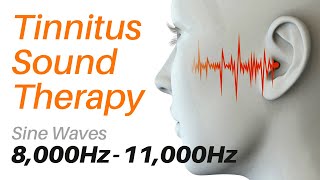 Tinnitus Sound Therapy  Sine Waves 8000Hz  11000Hz with Screensavers  Noises Inside Head [upl. by Ainesy258]