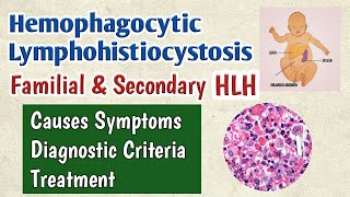 HLH Hemophagocytic Lymphohistiocytosis Causes Symptoms Diagnosis amp Treatment  Familial FHL [upl. by Ivanah]