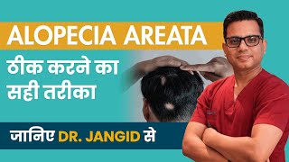 Alopecia Areata Treatment Process 2024  Patchy Hair Loss Diagnosis  By Dr Jangid  SkinQure [upl. by Andromede]