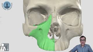 Skull  Norma Frontalis [upl. by Leventhal]