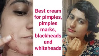 Best cream for pimples pimple marks blackheads and whiteheads  skin transformation [upl. by Urbanna]