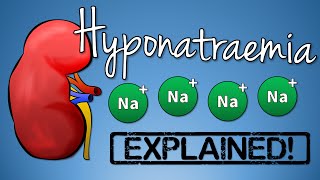 Hyponatremia EXPLAINED with Animation [upl. by Latsyrk]