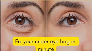 HOW TO GET RID OF PUFFY EYES  DARK UNDER EYES IN MINUTES [upl. by Nyrek]