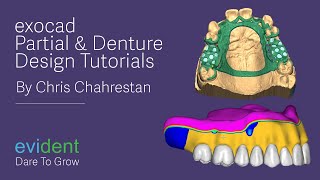 exocad Partial and Denture Design Tutorials  Evident Digital  Dental CAD Design [upl. by Elocaj]