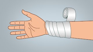 Bandaging Technique  Reverse Spiral [upl. by Rheinlander128]