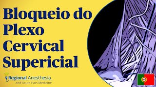 Bloqueio do Plexo Cervical Superficial [upl. by Akinohs]