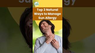 Top 3 Natural Ways to Avoid Sun Allergy Skin Rash shorts [upl. by Milka]