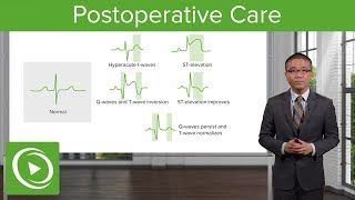 Postoperative Care – Surgery  Lecturio [upl. by Mosera]