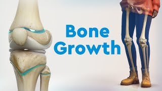 Bone Growth and Limb Deformities [upl. by Itnavart]