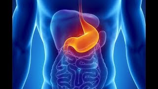 What is Dyspepsia What causes Dyspepsia Symptoms and Treatment of Indigestion [upl. by Einitsed]