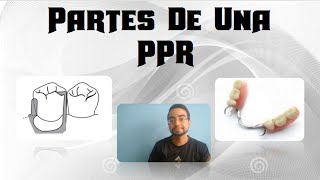 miniClase Partes De Una Prótesis Parcial Removible PPR [upl. by Frodine]