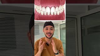 La solution pour le sourire gingival حل الابتسامة اللثوية souriregingivaldentistetanger [upl. by Nivart75]