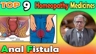 Anal Fistula Causes Symptoms and homeopathy Treatment  Dr P S Tiwari [upl. by Bolling]