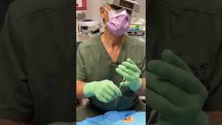 W Plasty Scar revision with Dr Richard Buckley [upl. by Lraed]