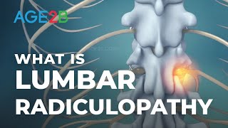 What Is Lumbar Radiculopathy  Lumbar Nerve Roots  Disc Bulge [upl. by Delanos]