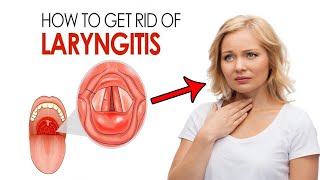 How To Get Rid Of Laryngitis Fast at Home  Home Remedies for Laryngitis Treatment [upl. by Germann]