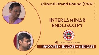 Interlaminar Endoscopy Clinical Grand Rounds [upl. by Irtemed]